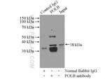 DNA polymerase beta Antibody in Immunoprecipitation (IP)