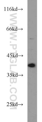 DNA polymerase beta Antibody in Western Blot (WB)