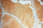 ST8SIA3 Antibody in Immunohistochemistry (Paraffin) (IHC (P))