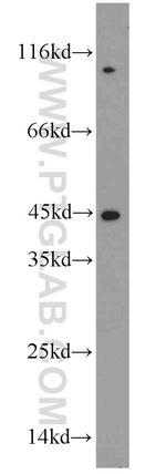 ST8SIA3 Antibody in Western Blot (WB)