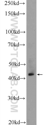 RRM2B/p53R2 Antibody in Western Blot (WB)