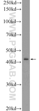 RRM2B/p53R2 Antibody in Western Blot (WB)