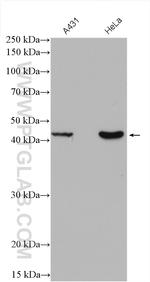 RRM2B/p53R2 Antibody in Western Blot (WB)