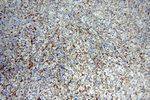 MME/CD10 Antibody in Immunohistochemistry (Paraffin) (IHC (P))