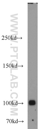 MME/CD10 Antibody in Western Blot (WB)