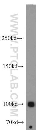 MME/CD10 Antibody in Western Blot (WB)