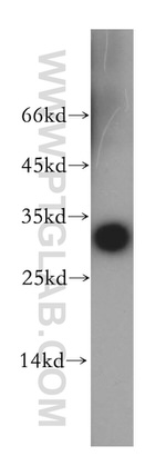 Nucleoside phosphorylase Antibody in Western Blot (WB)