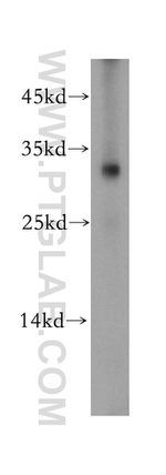 Nucleoside phosphorylase Antibody in Western Blot (WB)