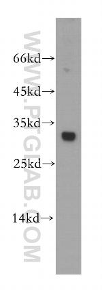 Nucleoside phosphorylase Antibody in Western Blot (WB)