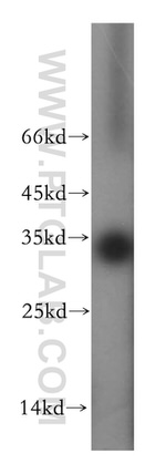 EIF2B1 Antibody in Western Blot (WB)