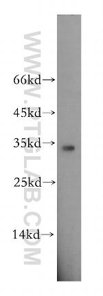 EIF2B1 Antibody in Western Blot (WB)