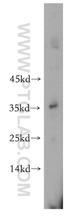 ATPAF1 Antibody in Western Blot (WB)