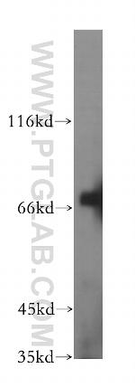 ICA1L Antibody in Western Blot (WB)