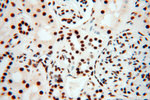 SART3 Antibody in Immunohistochemistry (Paraffin) (IHC (P))