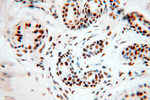 SART3 Antibody in Immunohistochemistry (Paraffin) (IHC (P))