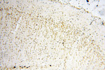 SART3 Antibody in Immunohistochemistry (Paraffin) (IHC (P))