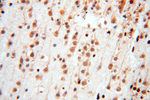 SART3 Antibody in Immunohistochemistry (Paraffin) (IHC (P))