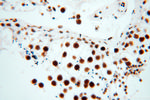 SART3 Antibody in Immunohistochemistry (Paraffin) (IHC (P))