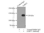 SART3 Antibody in Immunoprecipitation (IP)