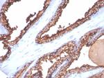 CD26 (DPP IV/ADA-Binding Protein) Antibody in Immunohistochemistry (Paraffin) (IHC (P))