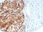 CD26 (DPP IV/ADA-Binding Protein) Antibody in Immunohistochemistry (Paraffin) (IHC (P))