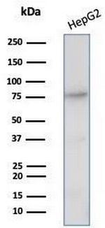 CD26 (DPP IV/ADA-Binding Protein) Antibody in Western Blot (WB)