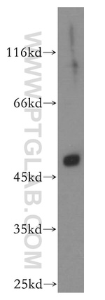 EDAR Antibody in Western Blot (WB)