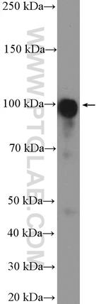 LONP2 Antibody in Western Blot (WB)