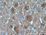 SAP102 Antibody in Immunohistochemistry (Paraffin) (IHC (P))