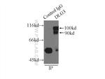 SAP102 Antibody in Immunoprecipitation (IP)