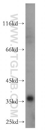 CCNY Antibody in Western Blot (WB)