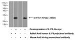 IL36 Beta/IL1F8 Antibody in Western Blot (WB)