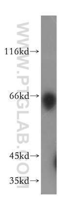 LGI2 Antibody in Western Blot (WB)