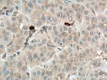 MLN51/CASC3 Antibody in Immunohistochemistry (Paraffin) (IHC (P))