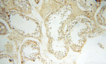 DNA Ligase I Antibody in Immunohistochemistry (Paraffin) (IHC (P))