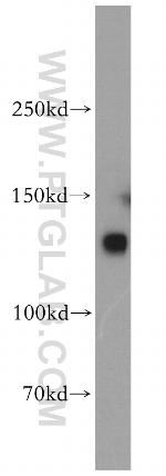 DNA Ligase I Antibody in Western Blot (WB)