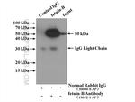 fetuin-B Antibody in Immunoprecipitation (IP)