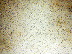 PTPN14 Antibody in Immunohistochemistry (Paraffin) (IHC (P))