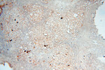 PTPN14 Antibody in Immunohistochemistry (Paraffin) (IHC (P))