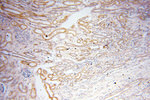 PTPN14 Antibody in Immunohistochemistry (Paraffin) (IHC (P))