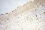 PTPN14 Antibody in Immunohistochemistry (Paraffin) (IHC (P))