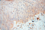 PTPN14 Antibody in Immunohistochemistry (Paraffin) (IHC (P))