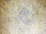 PTPN14 Antibody in Immunohistochemistry (Paraffin) (IHC (P))