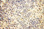 PTPN14 Antibody in Immunohistochemistry (Paraffin) (IHC (P))