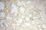 PTPN14 Antibody in Immunohistochemistry (Paraffin) (IHC (P))