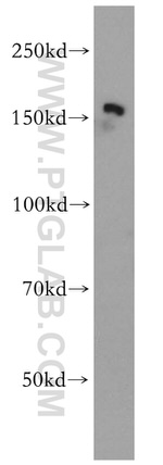 PTPN14 Antibody in Western Blot (WB)