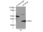 ALDOB Antibody in Immunoprecipitation (IP)