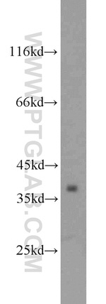 ALDOB Antibody in Western Blot (WB)