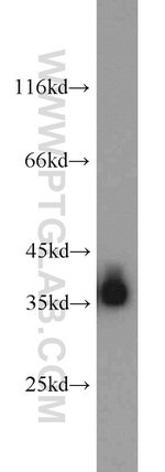 ALDOB Antibody in Western Blot (WB)