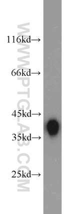 ALDOB Antibody in Western Blot (WB)